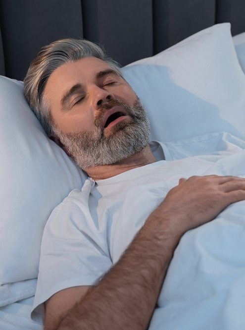 a snoring man asleep in a bed