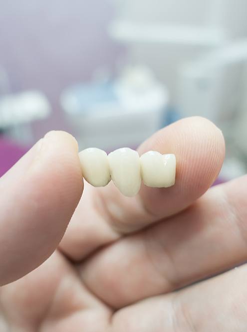 A dental bridge held between a thumb and index finger