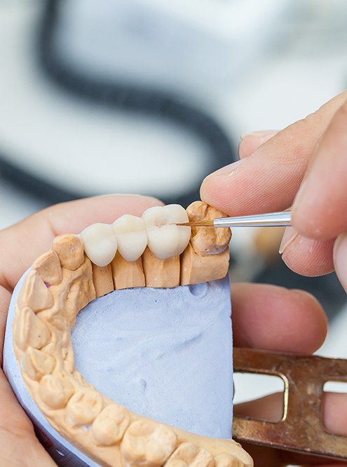 A dental technician working on a dental bridge